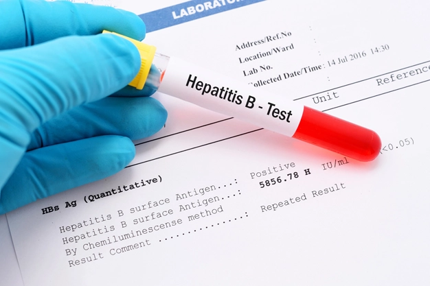 Hepatitis-B Testube